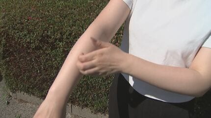 【蚊】「О型の人」「黒い服を着ている人」は刺されやすい?　ウソ?ホント?専門家に聞いた
